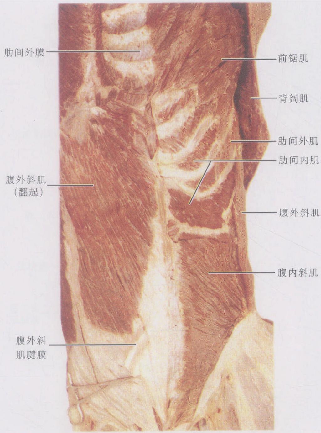 图1-3-24 腹内斜肌